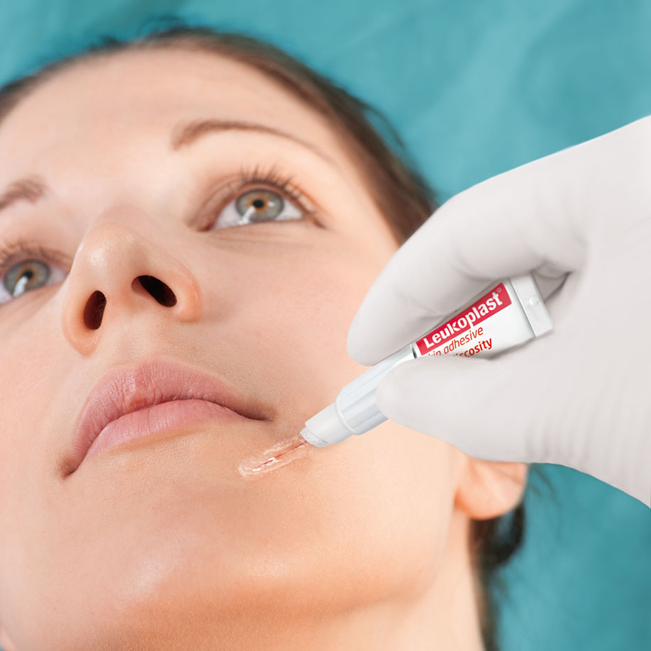 leukoplast-skin-adhesive-hautkleber-dosiertuben-036-ml-10-stck.-uk-=-8-anwendung