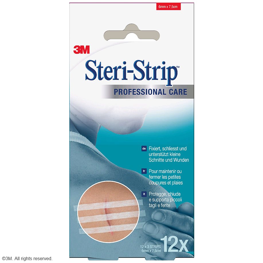 3m-steri-strip-wundverschlussstreifen-6-x-75-mm-12-x-3-str.-anwendung