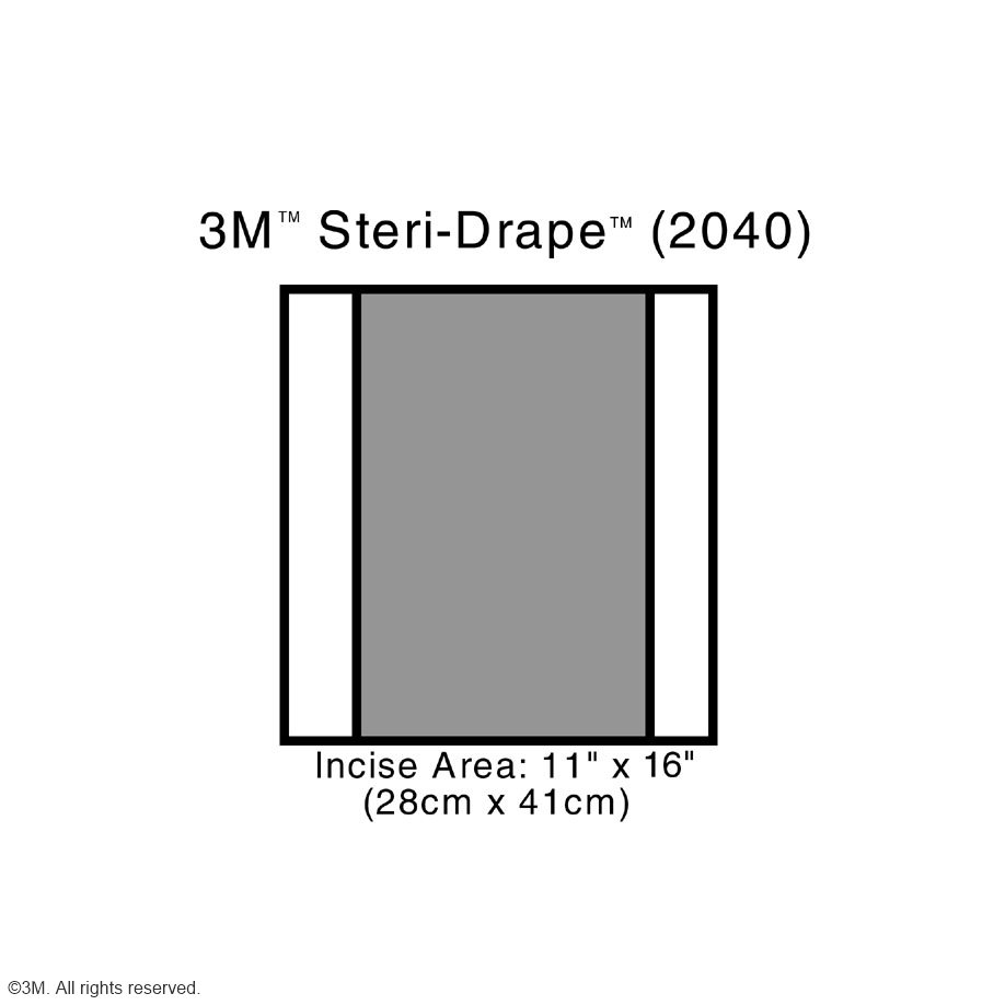 3M Steri-Drape 2 Inzisionsfolien 41 x 38 cm Inzisionsfeld 41 x 28 cm – 4 Packungen, je 10 Stück