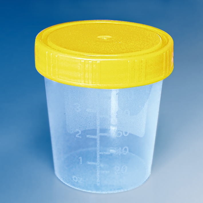[U17300] Urinbecher 100 ml mit Schraubdeckel gelb montiert, bestrahlt (5 Stck.)
