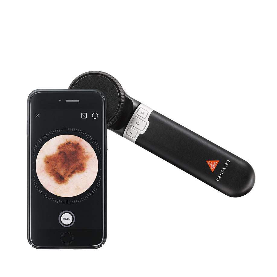 [U20427] DELTA 30 Dermatoskop LED mit Kontaktscheibe mit Skala, USB Kabel mit med. zugelassenem Steckernetzteil und Etui