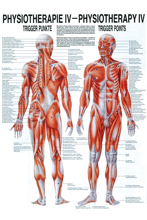 [U21456] anat. Poster: Physiotherapie Triggerpunkte, 50 x 70 cm, Papier zweisprachig